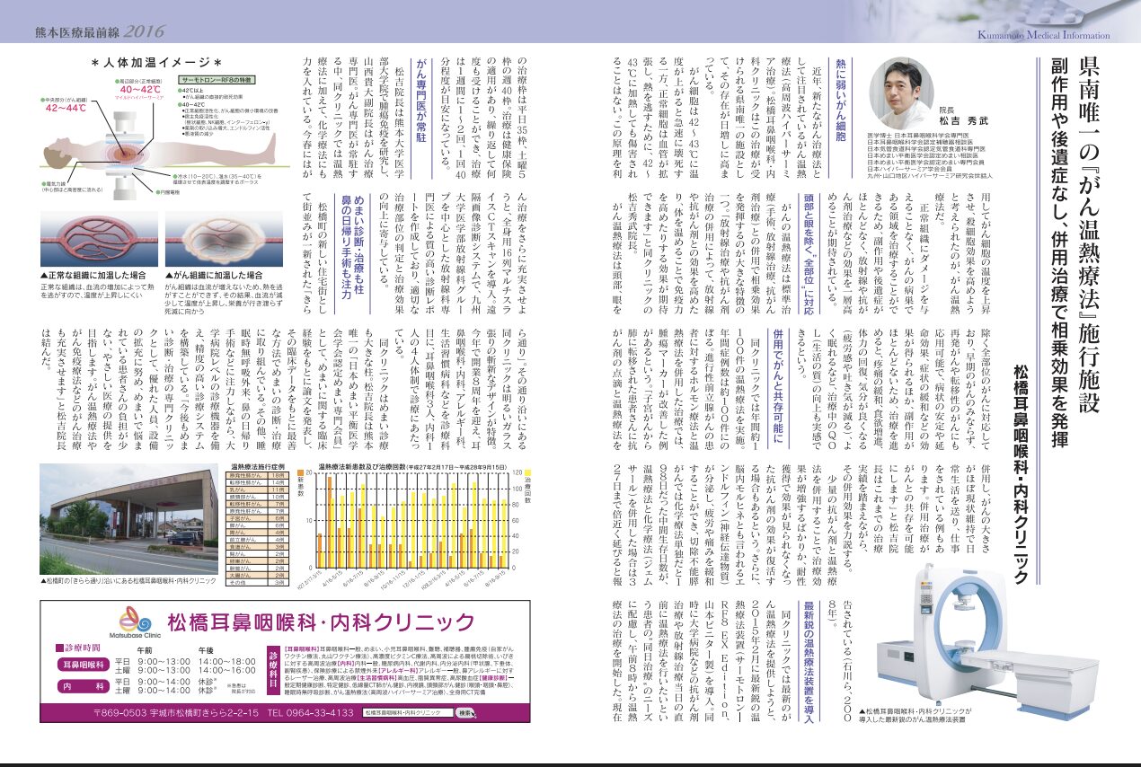 コラム：サムネイル画像