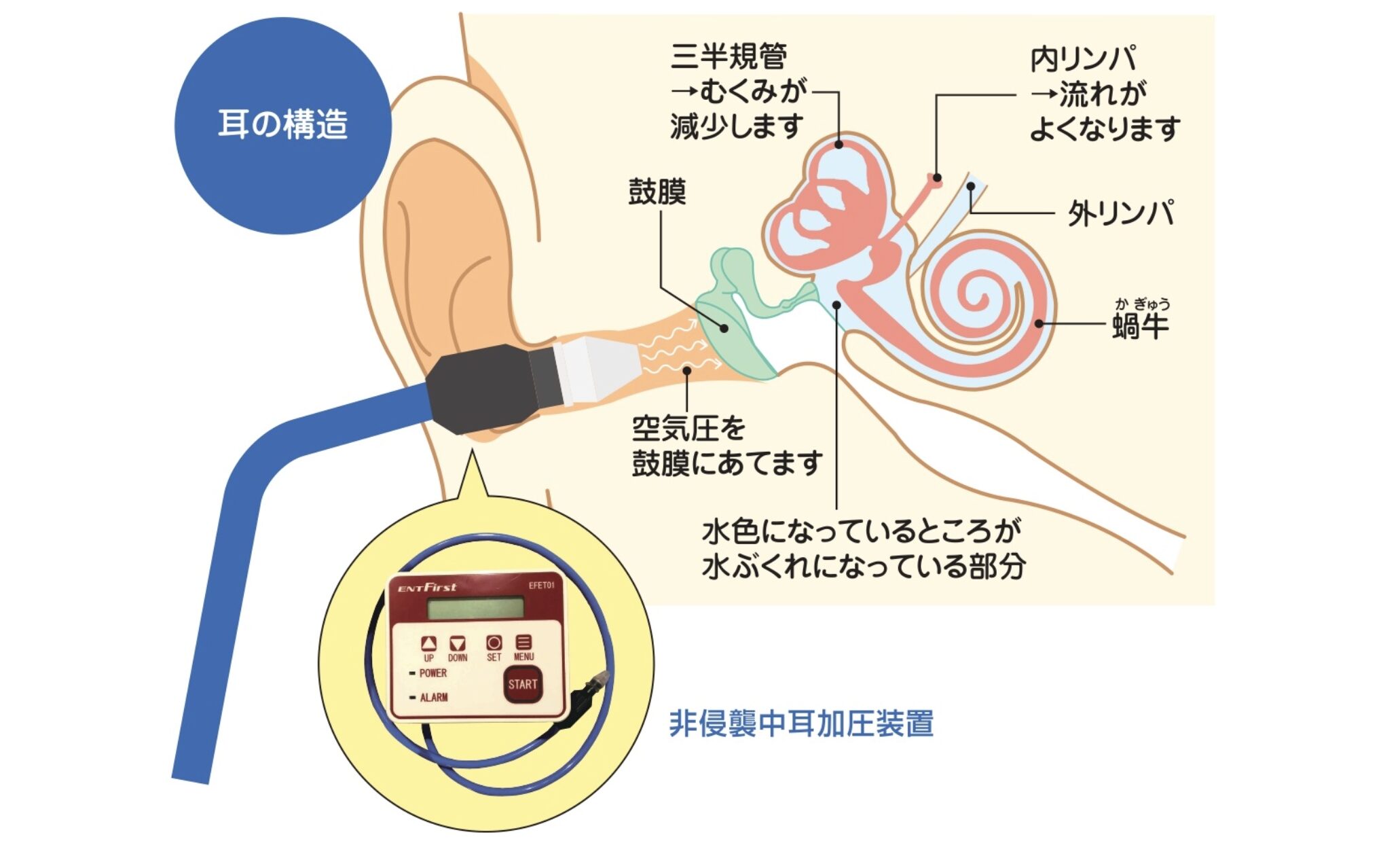 コラム：サムネイル画像